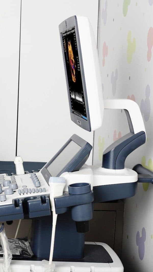 Aparelho de ecocardiograma com imagem colorida do coração na tela
